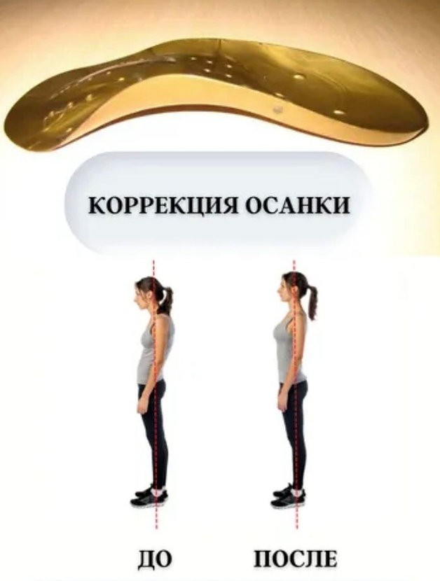 коррекция осанки