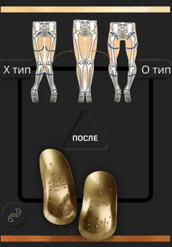 лечебные стельки